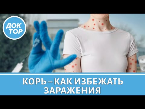 Видео: Врач-инфекционист ответила, чем страшна корь