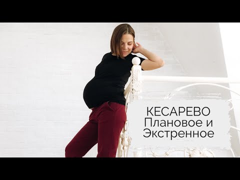 Видео: КЕСАРЕВО СЕЧЕНИЕ плановое и экстренное. Мой опыт. 2 часть