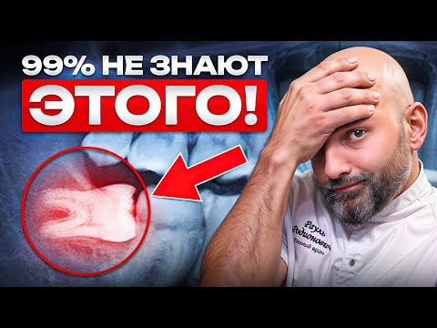 Видео: 🦷 ЗУБЫ МУДРОСТИ - ГЛАВНАЯ УГРОЗА ВАШЕЙ УЛЫБКИ!