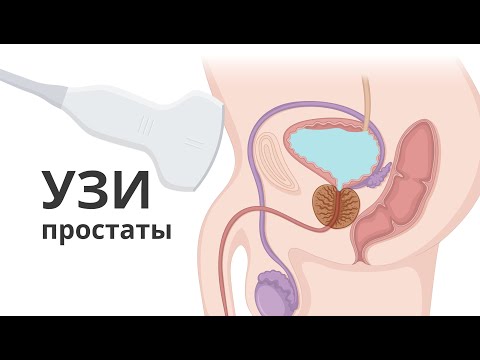 Видео: УЗИ простаты. Топ 5 ошибок при проведении ультразвуковой диагностики предстательной железы