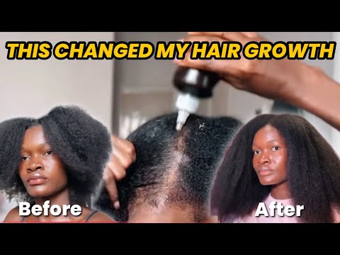 Видео: Мои волосы так сильно выросли из-за этого | Естественные секреты роста волос, которые вам НУЖНО з...