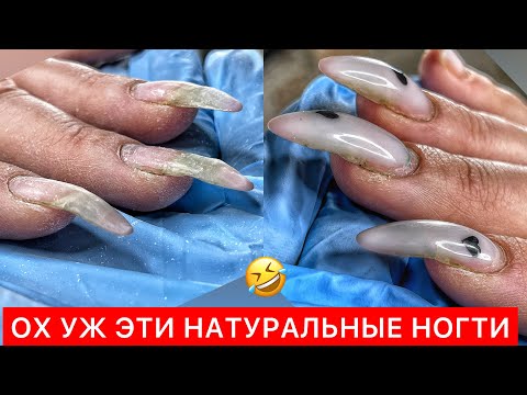 Видео: ТРЕШ КОРРЕКЦИЯ КЛЮЮЩИХ НОГТЕЙ🤬 ФРАНЦУЗКИЙ МАНИКЮР