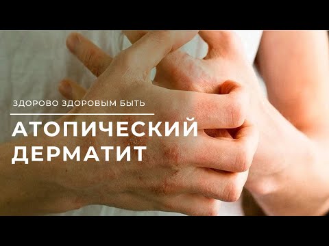 Видео: Что может разбудить атопический дерматит?