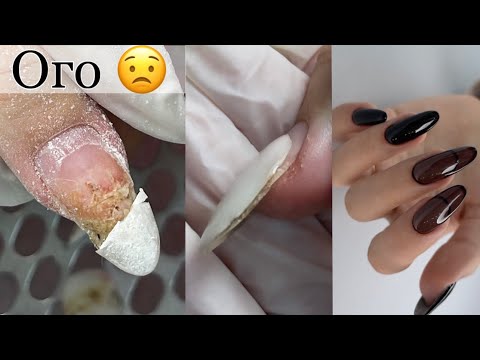 Видео: Коррекция ногтей/Укрепление гелем