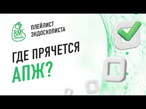 Видео: 🟢Аберрантная поджелудочная железа/#PlaylistЭндоскописта/АПЖ/Клинический случай