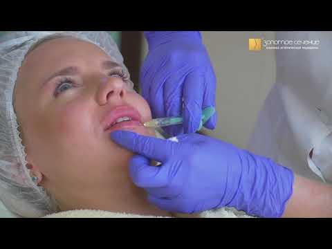 Видео: Контурная пластика губ. Результат до и после увеличения губ. Естественная коррекция формы губ!