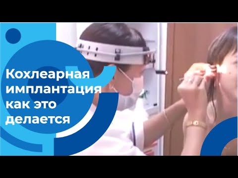 Видео: Кохлеарная имплантация: как восстановить слух и вернуть радость жизни