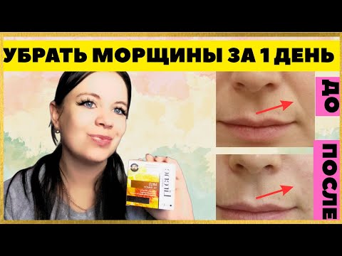 Видео: КРЕМ ОТ МОРЩИН за один день 