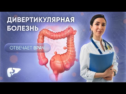 Видео: Дивертикулярная болезнь толстой кишки: причины, симптомы, обследование