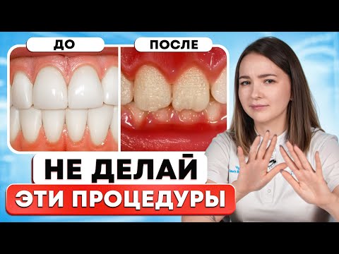 Видео: 6 самых БЕСПОЛЕЗНЫХ ПРОЦЕДУР в стоматологии!