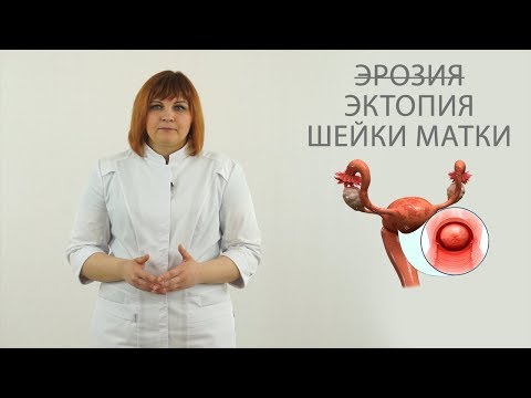 Видео: эрозия  ( эктопия )  шейки матки