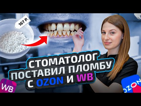 Видео: Стоматолог РАЗОБЛАЧАЕТ пломбы за 167 рублей с WB и OZON