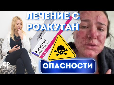 Видео: Лечение с РОАКУТАН - какво трябва да знаем!😬 ЗДРАВА и КРАСИВА КОЖА Е02