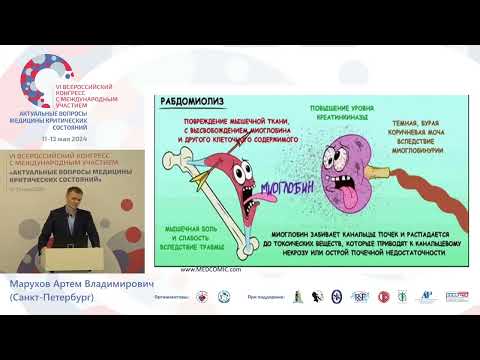 Видео: Нефропротекция в ИТ острого повреждения почек Марухов А.В.