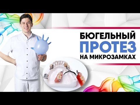 Видео: Бюгельный протез на микрозамках на верхнюю и нижнюю челюсть [ 6 преимуществ над другими протезами ].