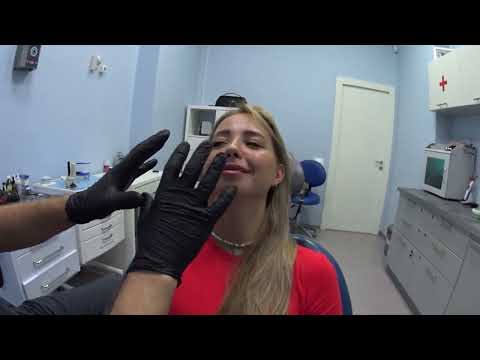 Видео: Заклинило челюсть и рот перестал открываться в день рождения!