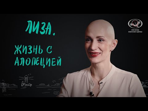 Видео: Лиза. Жизнь с алопецией. Интервью для вМесте