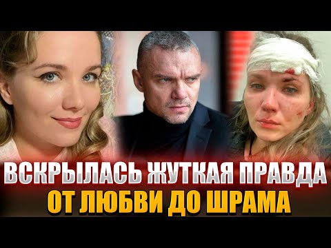 Видео: ИЗМЕНЫ, ДРАКИ, ШРАМ НА ЛИЦЕ - Вся горькая правда о жизни с Владимиром Епифанцевым