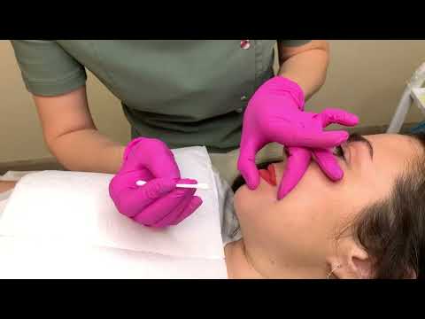 Видео: Положение рук при ПМ губ