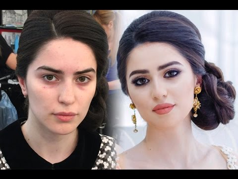 Видео: Жирная коррекция лица / Correction of the face