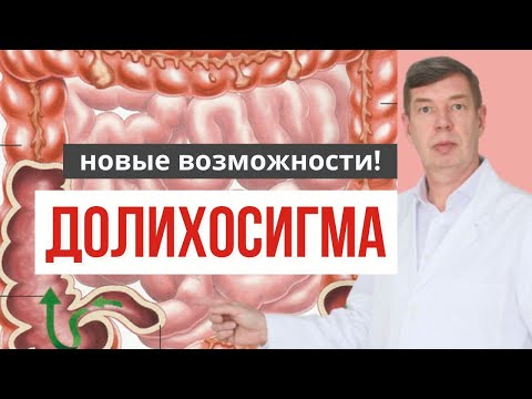 Видео: Вялый и ленивый кишечник. ДОЛИХОСИГМА. Избавление от атонических запоров.