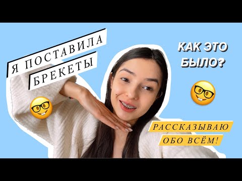 Видео: Я ПОСТАВИЛА БРЕКЕТЫ! Всё о моих ощущениях🦷 КАК ЭТО БЫЛО?🤓