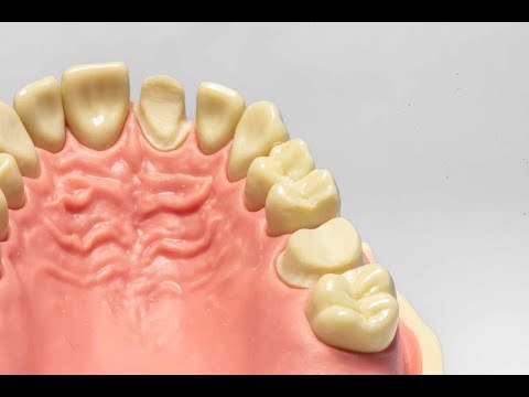 Видео: Препарирование зуба под пластмассовую и фарфоровую коронки. Лекция от 04.12.2020
