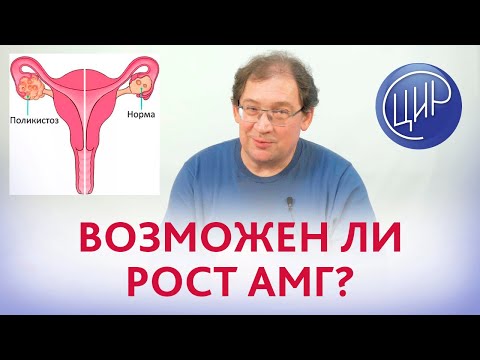 Видео: Анализ АМГ. Возможно ли увеличение АМГ с 0,89 нг/мл до 3,5 нг/мл за 2 года? Отвечает Гузов И.И.