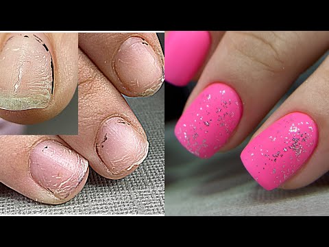 Видео: Отодрала все ногти 😬 Ногти тряпочки💅 Наращивание без форм за час💅 Зимний дизайн ногтей / Маникюр