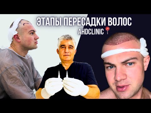 Видео: ПЕРЕСАДКА ВОЛОС МЕТОДОМ DHI,В КЛИНИКЕ ДОКТОРА ДОГАНАЙ. ВЛОГ ОТ НИКИТЫ ИГОШЕВА
