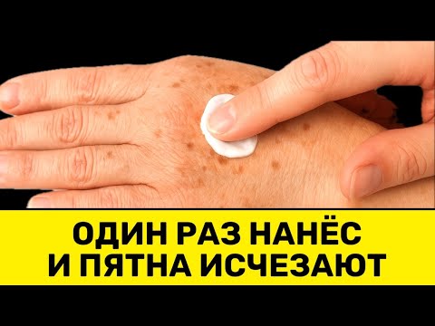 Видео: Пожилые, попробуйте один раз — и ТЁМНЫЕ ПЯТНА НАЧНУТ ИСЧЕЗАТЬ прямо на глазах!