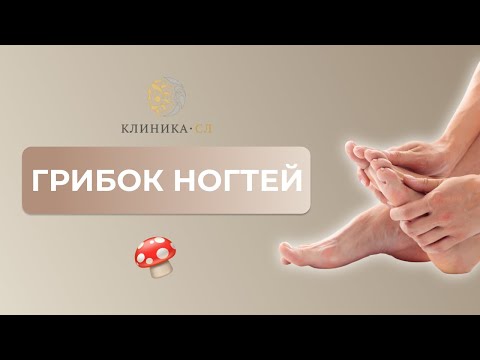 Видео: Грибок ногтей
