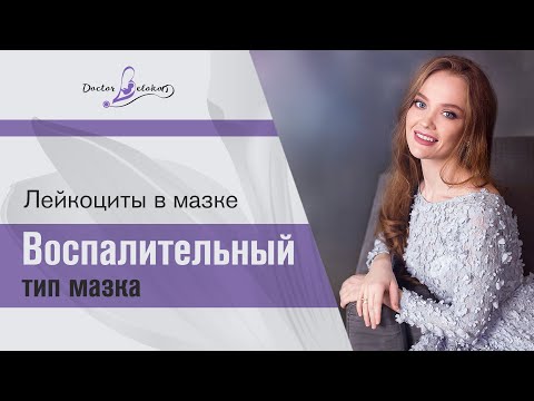 Видео: Воспалительный тип мазка. Лейкоциты в мазке