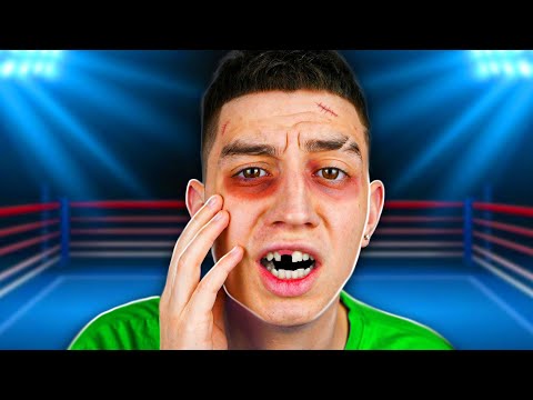 Видео: МЕНЯ ИЗБИЛИ ! ТУРНИР ПО ПОЩЕЧИНАМ **Я ПРОИГРАЛ** SLAP KINGS