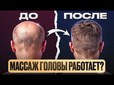 Видео: МАССАЖ ГОЛОВЫ ДЛЯ ВОЛОС