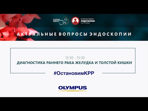 Видео: Симпозиум «Диагностика раннего рака желудка и толстой кишки»