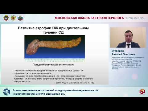 Видео: Доклад Буеверова А. О.  Взаимоотношения экзокринной и эндокринной панкреатической недостаточности