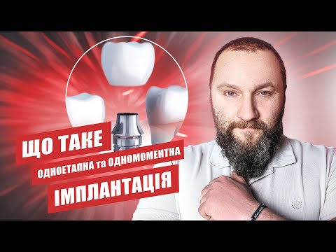 Видео: 🇺🇦 Що таке одномоментна імплантація зубів