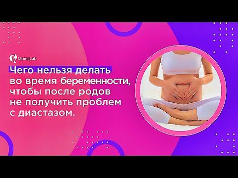 Видео: Спорт во время беременности: как избежать диастаза, расхождение прямых мышц живота. Профилактика