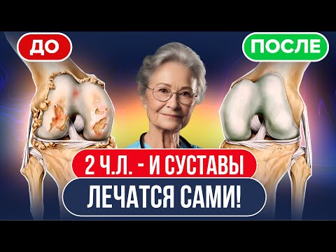 Видео: Ортопед: Удивительно быстрый эффект!ВОТ, что избавит от боли в суставах на 15 лет! От артрита,артоза