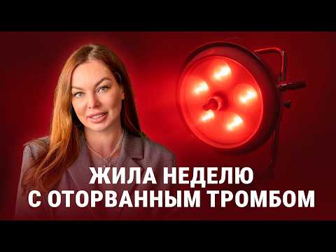 Видео: СЕРДЦЕ НАЧАЛО ГНИТЬ | Жила 5 дней с оторванным тромбом | Лечение самых страшных болезней | ТИТР