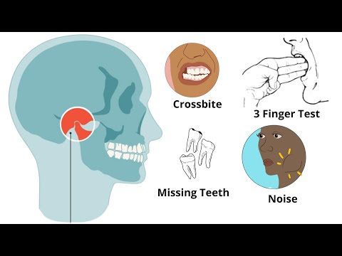 Видео: Ваша челюсть не сбалансирована? Неровная челюсть: причины и методы лечения (ОБЯЗАТЕЛЬНО ЗНАЙТЕ)