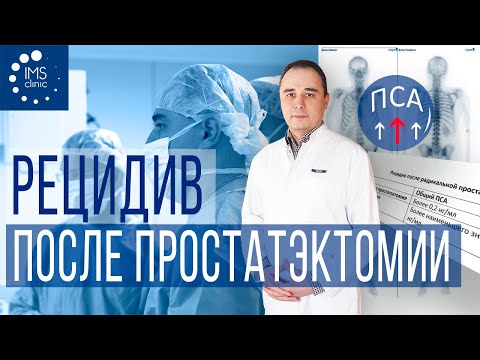 Видео: Рецидив после простатэктомии