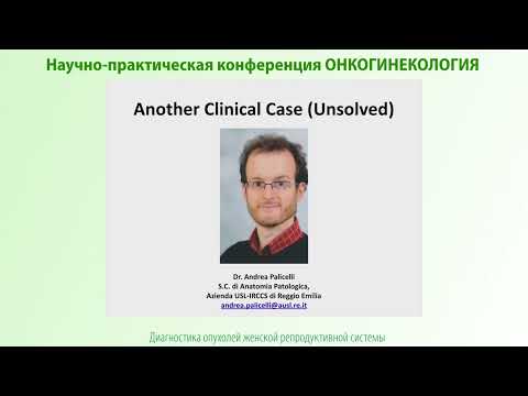 Видео: Мезонефроподобная аденокарцинома тела матки: трудности диагностики