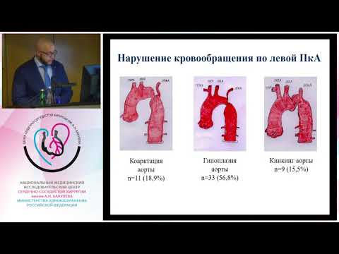 Видео: Защита диссертации Сыромятников Д. Д.