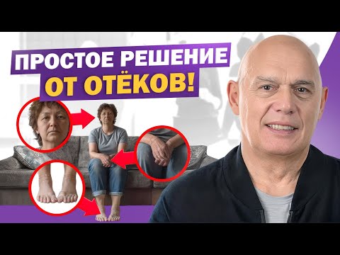 Видео: Не игнорируй отёки! Причины и эффективные методы борьбы