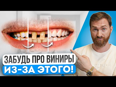 Видео: ВИНИРЫ в 2025: Самые частые ОШИБКИ, из-за которых ПОРТЯТСЯ ВИНИРЫ! 9 из 10 людей СОВЕРШАЮТ их!