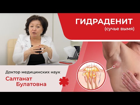 Видео: Гидраденит: причины, симптомы, лечение