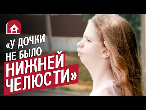 Видео: У моей дочери синдром Франческетти: Света | Быть мамой