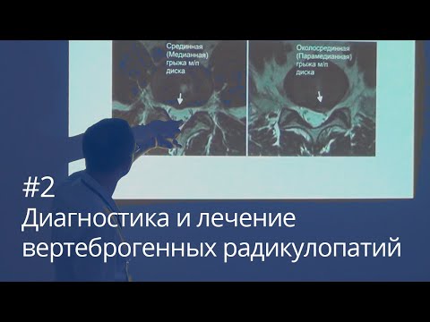Видео: Диагностика и лечение вертеброгенных радикулопатий (часть 2)